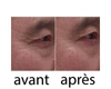 Wrinkle power x2